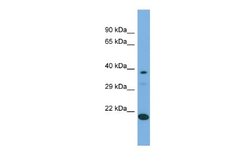 LIPT2 Rabbit anti-Human, Polyclonal, Novus Biologicals 0.1ml; Unconjugated:Antibodies,